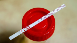 Bremerhaven: Polizei vereitelt T&auml;uschungsversuch mit Kunstpenis und falschem Urin