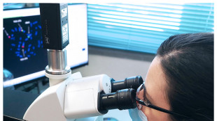 Cellule pelle riprogrammate in ovociti,nuove terapie infertilit&agrave;