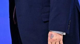 Trump bruised hand on table, White House says of new photos