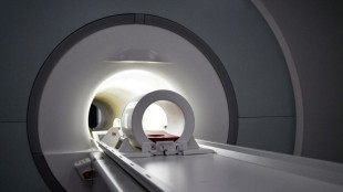 Una nueva herramienta de IA ayuda a localizar lesiones en ni&ntilde;os epil&eacute;pticos