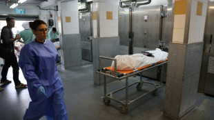 "Jam&aacute;s vi este nivel de barbarie": Israel muestra los cuerpos masacrados por Ham&aacute;s