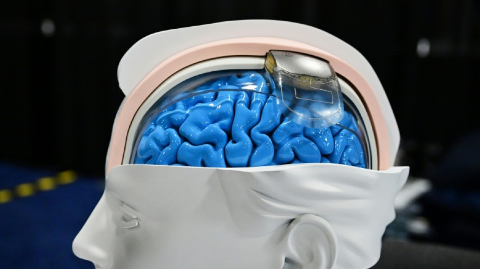 "On est d&eacute;j&agrave; dans la science-fiction": la discr&egrave;te r&eacute;volution des neurotechnologies