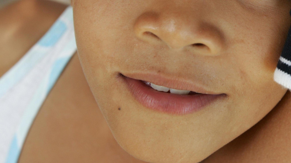  Metalli dannosi per i bambini, lo dicono i denti da latte 