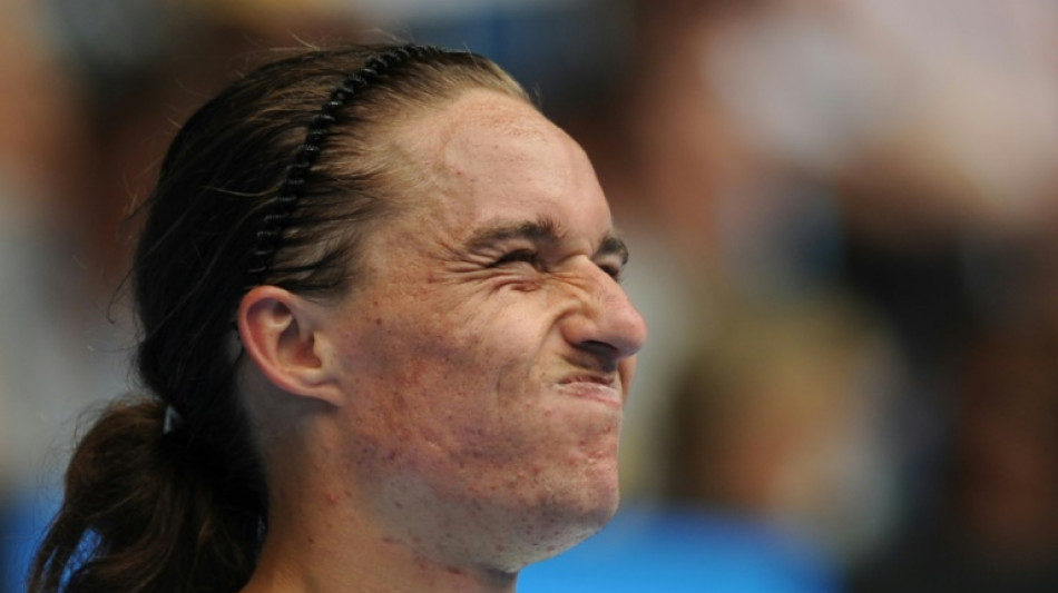 Ucrania necesita m&aacute;s ayuda, reclama Dolgopolov, tenista reconvertido en soldado