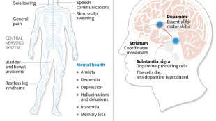Japan approves stem-cell treatment for Parkinson's in world first