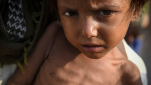 Las enfermedades acechan tras las inundaciones en Pakist&aacute;n 
