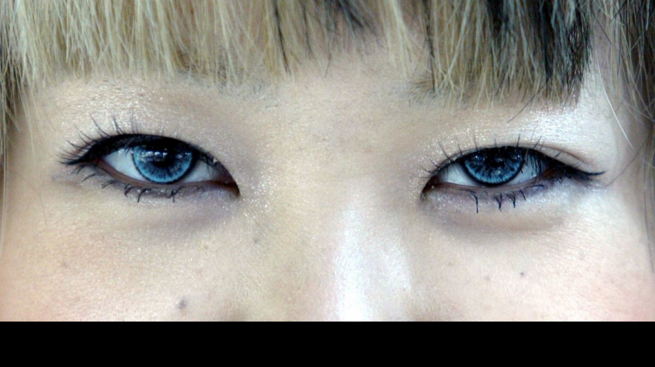  Lenti a contatto smart rilasciano farmaci per il glaucoma 