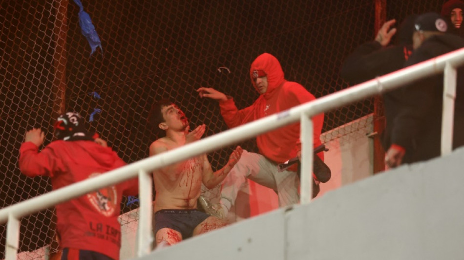  Violences entre supporters en Argentine: 19 blessés dont 3 graves, plus de 100 arrestations 